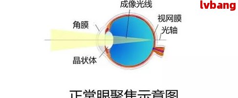 視網膜脫落工傷賠償標準是多少錢